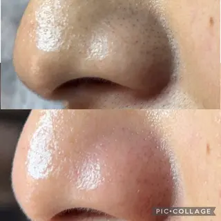 Frele Komiのエステ・リラクイメージ