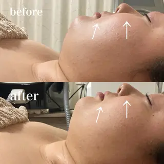 磐田｜LAYLA 一番丁寧な脱毛店のエステ・リラクイメージ