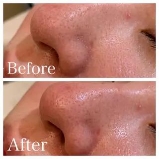 Beauty salon  Liko所属・LIKO フェイシャル&ボディのエステ・リラクイメージ