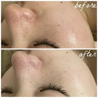 メンズ メナード岐阜市茜部 杉浦のエステ・リラクイメージ