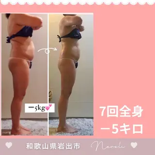 温活beautyサロンNeroli所属・切らない脂肪吸引🔥 Neroliまりこのエステ・リラクイメージ