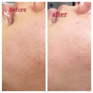 🅖🅤🅩🅔🅛 salonのエステ・リラクイメージ