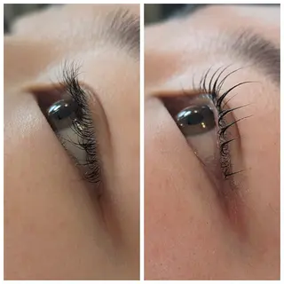 マツエク・マツパ 結果が出るスキンケア 肌質改善/まつパのエステ・リラクイメージ