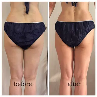 武藤 千裕のエステ・リラクイメージ