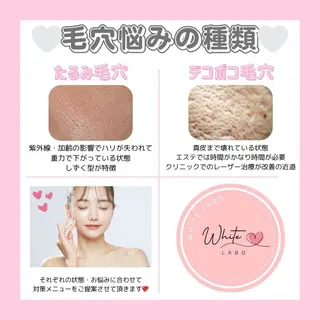 肌管理専門店Whitelabo堺東店所属・おだ あみのエステ・リラクイメージ