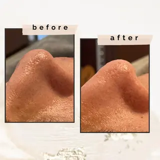 腸もみ・メンズ脱毛・ 毛穴洗浄〜カナロア〜のエステ・リラクイメージ