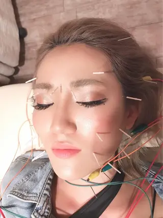 むくみたるみ専門☆ 美容鍼・小顔矯正のエステ・リラクイメージ