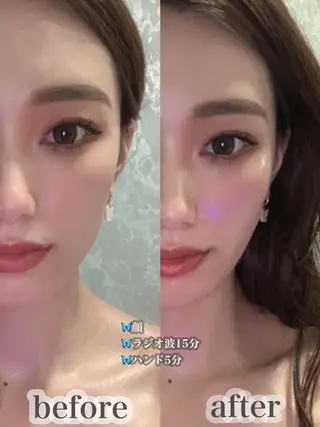 LAGRECE 大阪梅田店のエステ・リラクイメージ