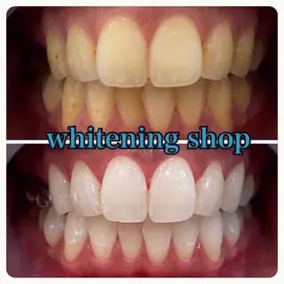 ホワイトニング ショップ吉祥寺店のエステ・リラクイメージ