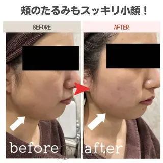 メンズ ✨美肌＆痩身エステ✨ be feel千葉店のエステ・リラクイメージ