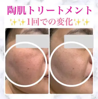 Lumiere despoir所属・Lumiere despoirのエステ・リラクイメージ