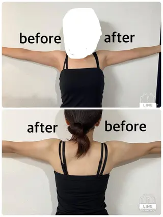 脱毛/痩身/頭皮ケア GLYCINEのエステ・リラクイメージ