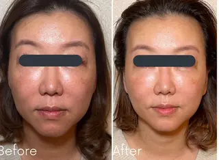 アプローズ所属・恵比寿INDIBA アプローズのエステ・リラクイメージ