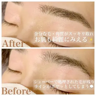 アイブロウ ハーブピーリング専門EMILUCA藤沢所属・ハーブピーリング /KAEDEのエステ・リラクイメージ