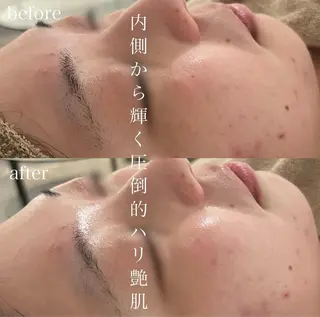 blan. beauty salon所属・blan. /岡本/ 神戸ハーブピーリングのエステ・リラクイメージ