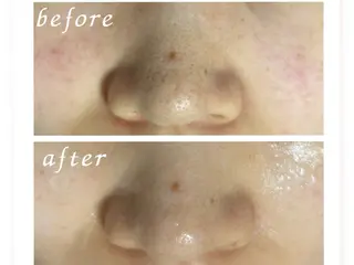 ホワイト ターコイズのエステ・リラクイメージ