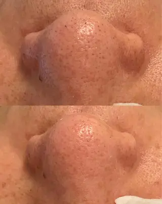 メンズ Remina clinical salon所属・ハイフ美肌専門 Remina.c.sのエステ・リラクイメージ