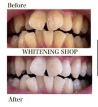 ホワイトニングショップ津店所属・ホワイトニング ショップ津店のその他イメージ