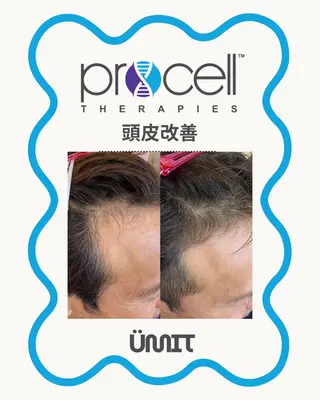 メンズ Ümit（ユミト） プロセルセラピーズのネイルデザイン