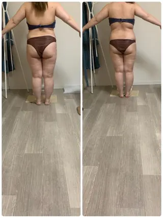 美ボディメイクサロン　only one body所属・所沢 痩身エステサロンのエステ・リラクイメージ