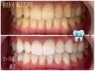 札幌ホワイトニング ラディアンス札幌駅店のその他イメージ