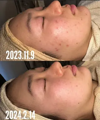 a room salonのエステ・リラクイメージ