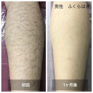 脱毛 Beauty salon Lumiere(ルミエール)所属・完全都度払い脱毛⭐︎ Lumiereのエステ・リラクイメージ