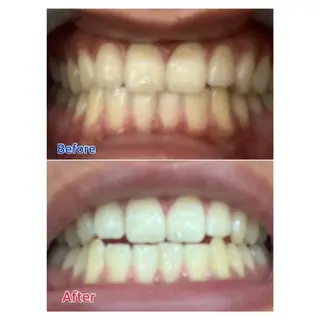 MBEAUTYSALON 千葉店・京成大久保所属・Melty 輝のその他イメージ