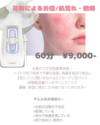 beauty  salon sorelle所属・艶肌/角質ケア フェイシャルワックスのエステ・リラクイメージ