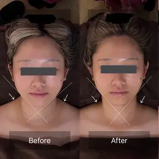 Linoas所属・kogao&head Linoasのその他イメージ