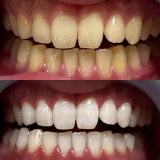 LOVE ホワイトニング新宿店のエステ・リラクイメージ