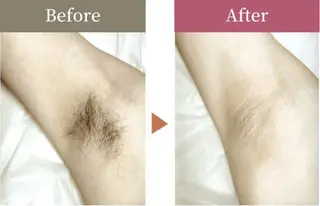 エステサロンスマイリー所属・ｴｽﾃｻﾛﾝ ｽﾏｲﾘｰ後藤理恵のエステ・リラクイメージ