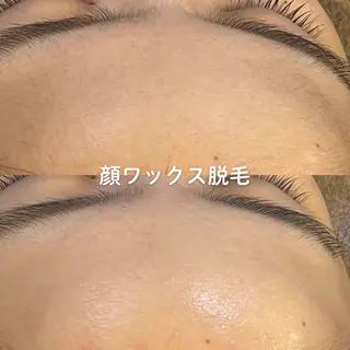 EST BEAUTY所属・顔ワックス脱毛/ ハーブピーリングのエステ・リラクイメージ