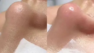 エイナミ肌質改善 小顔痩身サロンのエステ・リラクイメージ