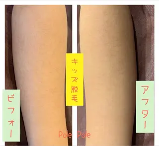 Pole Poleのエステ・リラクイメージ