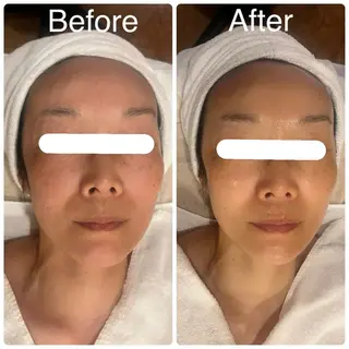 miel所属・毛穴＆ホワイトニング mielのエステ・リラクイメージ