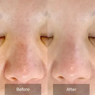 salon Shri所属・かとう みきのエステ・リラクイメージ