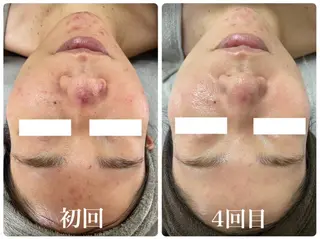 Esthe salon Blanche(エステサロンブランシュ)所属・小顔リフトアップ 美肌改善専門店のエステ・リラクイメージ