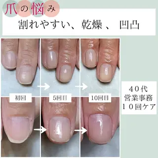 ネイル AKT NAIL所属・AKT Beauty エステヘッドスパのエステ・リラクイメージ