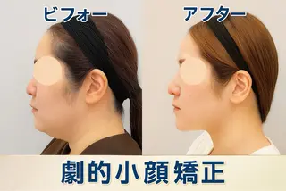 【歴13年】劇的小顔 D rマジックタッチのエステ・リラクイメージ