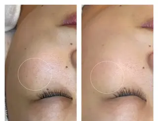 moe beauty salon所属・moe sayuriのエステ・リラクイメージ