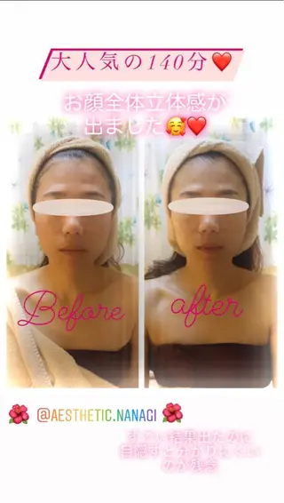 エステティック Nanagiのエステ・リラクイメージ