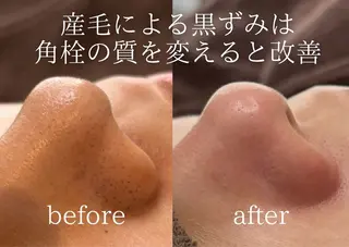 Peerless所属・chi kaのエステ・リラクイメージ