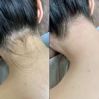 六本木脱毛andS さおりのエステ・リラクイメージ