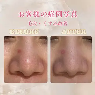 pansy(パンジー)上野フェイシャルエステ専門店所属・pansy saraのエステ・リラクイメージ