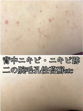 LILIANA所属・LILIANA ☆YURIのエステ・リラクイメージ