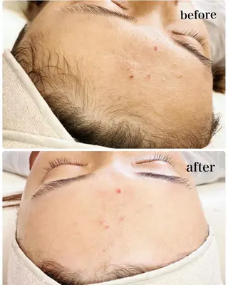 多摩境Beauty Salon  ViVi所属・多摩境ViVi chinamiのエステ・リラクイメージ