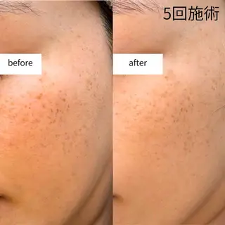 AIMER所属・AIMER アイブロウ／エステのネイルデザイン