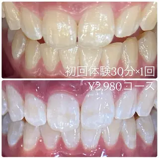 PLATINUM Beauty 横浜店所属・ホワイトニングルーム 横浜店のその他イメージ