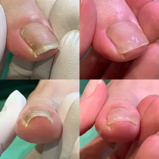 ネイル 東京巻き爪アカデミー所属・東京巻き爪 アカデミーのエステ・リラクイメージ